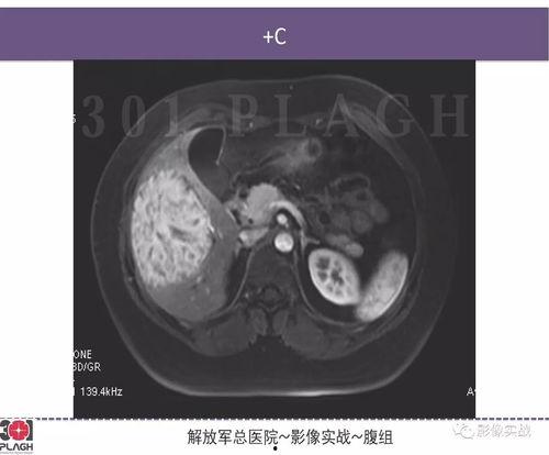301病理在线视频,深入解析病理诊断的奥秘