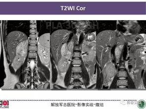 301病理在线视频,深入解析病理诊断的奥秘